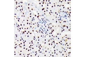 Immunohistochemistry of paraffin-embedded mouse kidney using U/DDX39B Rabbit mAb (ABIN7266696) at dilution of 1:100 (40x lens).
