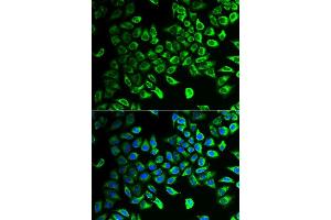 Immunofluorescence analysis of U2OS cells using DDAH2 antibody. (DDAH2 antibody  (AA 1-285))