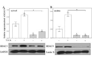 Western Blotting (WB) image for anti-Glyceraldehyde-3-Phosphate Dehydrogenase (GAPDH) antibody (ABIN2857072)