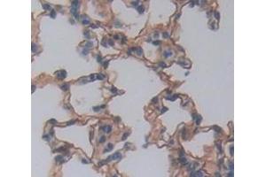 IHC-P analysis of Kidney tissue, with DAB staining. (TLR8 antibody  (AA 519-812))
