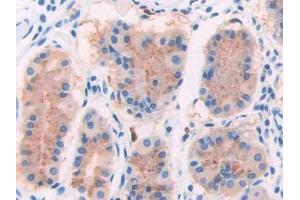 IHC-P analysis of Human Stomach Tissue, with DAB staining.