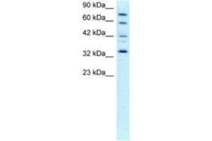 Western Blotting (WB) image for anti-Cyclin-Dependent Kinase 7 (CDK7) antibody (ABIN2463672) (CDK7 antibody)