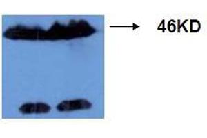 Western Blotting (WB) image for anti-Microtubule-Associated Protein tau (MAPT) (AA 177-187), (pThr181) antibody (ABIN1108155) (MAPT antibody  (pThr181))