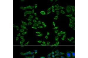 Immunofluorescence analysis of HeLa cells using VAPB Polyclonal Antibody (VAPB antibody)