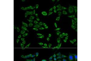 Immunofluorescence analysis of HeLa cells using VAPB Polyclonal Antibody