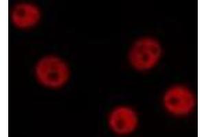ABIN6276756 staining Hela by IF/ICC. (ERCC5 antibody  (N-Term))