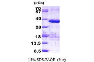 SDS-PAGE (SDS) image for Zinc Finger, AN1-Type Domain 1 (ZFAND1) (AA 1-268) protein (His tag) (ABIN5852954) (ZFAND1 Protein (AA 1-268) (His tag))
