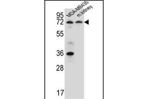 P2RX7 Antibody (C-term) (ABIN651861 and ABIN2840427) western blot analysis in MDA-M cell line and mouse kidney tissue lysates (15 μg/lane). (P2RX7 antibody  (AA 563-592))