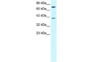 PCK1 antibody used at 0. (PCK1 antibody  (Soluble))