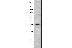 Western blot analysis GPR105 using HT29 whole cell lysates (P2RY14 antibody  (Internal Region))