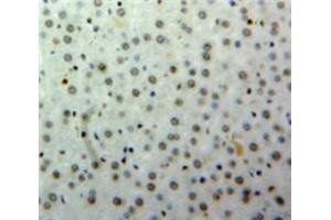 IHC-P analysis of Liver tissue, with DAB staining. (HNF1B antibody  (AA 159-300))