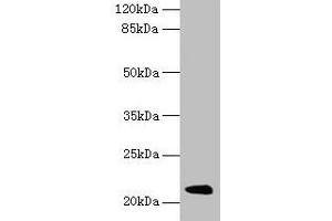 Major Urinary Protein 19 (MUP19) (AA 1-151) anticorps