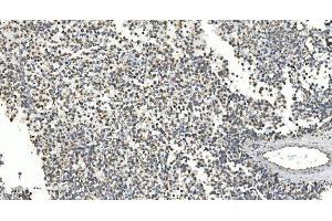 IHC analysis of NOX2/gp91phox/CYBB using anti-NOX2/gp91phox/CYBB antibody (ABIN7599875). (CYBB antibody  (AA 124-559))