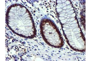 Image no. 3 for anti-Ubiquitin Specific Peptidase 7 (Herpes Virus-Associated) (USP7) antibody (ABIN1498592) (USP7 antibody)