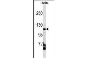FC Antibody (C-term) (ABIN1537556 and ABIN2849534) western blot analysis in Hela cell line lysates (35 μg/lane). (FAM65C antibody  (C-Term))