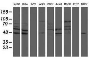Image no. 1 for anti-SUMO1/sentrin/SMT3 Specific Peptidase 2 (SENP2) (AA 139-523) antibody (ABIN1490927) (SENP2 antibody  (AA 139-523))