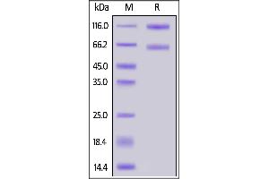 Human IL-2RB&IL-2RA&IL-2RG, Fc Tag&Fc Tag on  under reducing (R) condition. (IL-2 R beta & IL-2 R alpha & IL-2 R gamma (AA 22-212), (AA 23-254), (AA 27-239) (Active) protein (Fc Tag))
