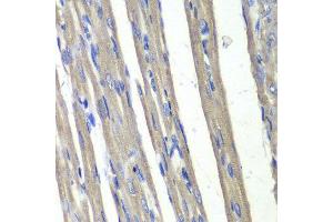 Immunohistochemistry (IHC) image for anti-Aldo-Keto Reductase Family 1, Member C3 (3-alpha Hydroxysteroid Dehydrogenase, Type II) (AKR1C3) (AA 1-323) antibody (ABIN3022536) (AKR1C3 antibody  (AA 1-323))