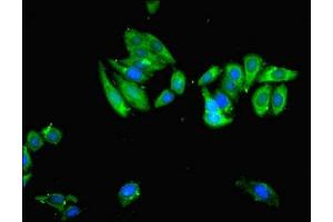 Immunofluorescent analysis of HepG2 cells cells using ABIN7174258 at dilution of 1:100 and Alexa Fluor 488-congugated AffiniPure Goat Anti-Rabbit IgG(H+L) (USP14 antibody  (C-Term))