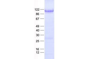 Validation with Western Blot (NRF2 Protein (His tag))