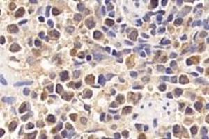 Immunohistochemistry analysis of paraffin-embedded rat inflammatory spleen using IL-17 (ABIN7074342) at dilution of 1:1600