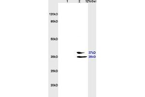 L1 rat heart, L2 rat brain lysates probed (ABIN687592) at 1:200 in 4 °C. (EpCAM antibody  (AA 221-314))