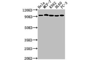Western Blot Positive WB detected in: Hela whole cell lysate, MCF-7 whole cell lysate, K562 whole cell lysate, HL60 whole cell lysate, PC-3 whole cell lysate All lanes: TOP1 antibody at 1:2000 Secondary Goat polyclonal to rabbit IgG at 1/50000 dilution Predicted band size: 91 kDa Observed band size: 91 kDa (Recombinant Topoisomerase I antibody)
