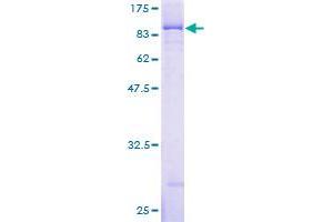 IGF2BP3 Protein (AA 1-579) (GST tag)
