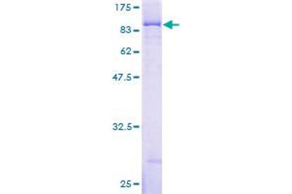 IGF2BP3 Protein (AA 1-579) (GST tag)