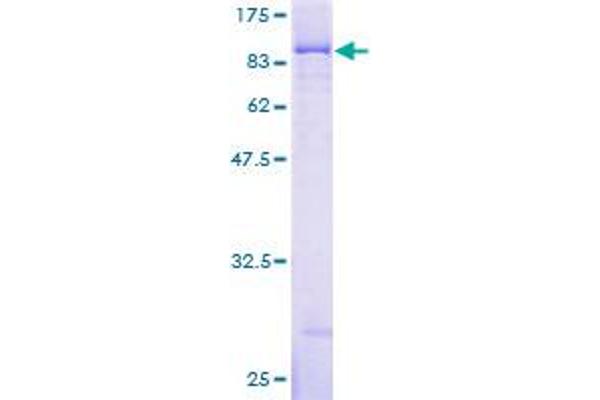 IGF2BP3 Protein (AA 1-579) (GST tag)