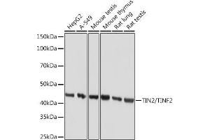 Western blot analysis of extracts of various cell lines, using TIN2/TINF2 Rabbit mAb (ABIN7270771) at 1:1000 dilution. (TINF2 antibody)