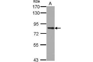 WB Image Sample (30 ug of whole cell lysate) A: A431 7. (PKC epsilon antibody)