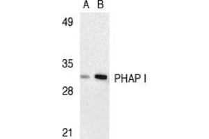 Image no. 1 for anti-Acidic (Leucine-Rich) Nuclear phosphoprotein 32 Family, Member A (ANP32A) (C-Term) antibody (ABIN205964) (PHAP1 antibody  (C-Term))