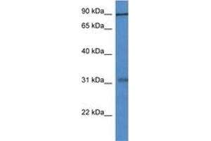 Image no. 1 for anti-Midline 2 (MID2) (AA 210-259) antibody (ABIN6746086) (Midline 2 antibody  (AA 210-259))
