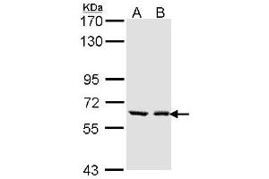 Image no. 1 for anti-UDP Glucuronosyltransferase 1 Family, Polypeptide A6 (UGT1A6) (AA 8-197) antibody (ABIN467620)