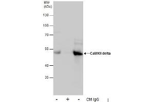 IP Image Immunoprecipitation of CaMKII delta protein from HepG2 whole cell extracts using 5 μg of CaMKII delta antibody, Western blot analysis was performed using CaMKII delta antibody, EasyBlot anti-Rabbit IgG  was used as a secondary reagent. (CAMK2D antibody)