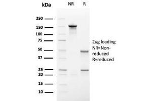 SDS-PAGE Analysis Purified Secretory Component Mouse Monoclonal Antibody (SC-05). (ECM1 antibody)