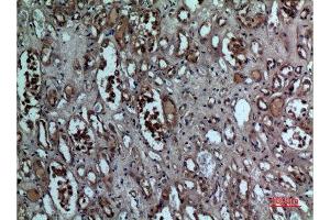 Immunohistochemistry (IHC) analysis of paraffin-embedded Human Kidney, antibody was diluted at 1:100. (BNIP3 antibody  (Internal Region))