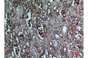 Immunohistochemistry (IHC) analysis of paraffin-embedded Human Kidney, antibody was diluted at 1:100. (BNIP3 antibody  (Internal Region))