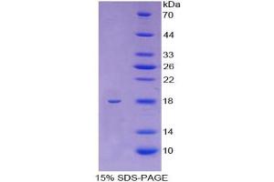 SDS-PAGE analysis of Human KIF5A Protein. (KIF5A Protein)