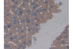 Detection of ASGR1 in Mouse Liver Tissue using Polyclonal Antibody to Asialoglycoprotein Receptor 1 (ASGR1) (Asialoglycoprotein Receptor 1 antibody  (AA 80-281))