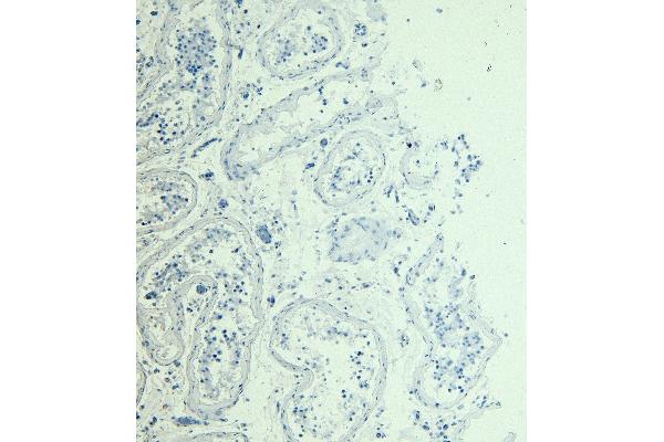 PPP1R12A antibody  (C-Term)