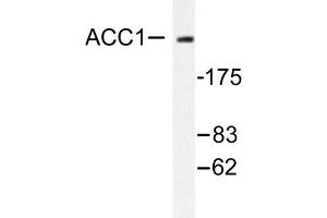 Image no. 1 for anti-Acetyl-CoA Carboxylase alpha (ACACA) antibody (ABIN271865) (Acetyl-CoA Carboxylase alpha antibody)