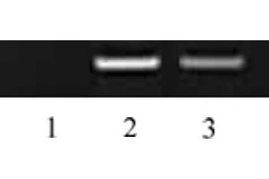 Histone H3 dimethyl Lys27 antibody tested by ChIP.