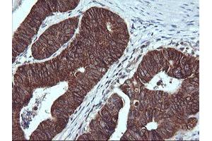 Immunohistochemistry (IHC) image for anti-Acetyl-CoA Acyltransferase 2 (ACAA2) antibody (ABIN1495727) (ACAA2 antibody)