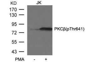 Western blot analysis of extracts from JK cells untreated or treated with PMA using PKCβ (phospho-Thr641) antibody. (PKC beta antibody  (pThr641))