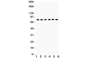 Western blot testing of tPA antibody and Lane 1:  mouse lung;  2: (m) testis; and human samples  3: U87;  4: A431;  5: A375;  6: A549 lysate (PLAT antibody  (AA 366-562))