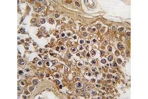 IHC analysis of FFPE human testis tissue stained with ALK antibody (ALK antibody  (AA 636-666))