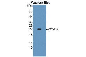Western Blotting (WB) image for anti-Slit Homolog 3 (SLIT3) antibody (Biotin) (ABIN1176109) (SLIT3 antibody  (Biotin))