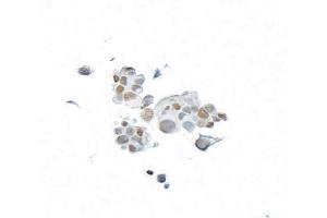 Immunocytochemistry (ICC) image for anti-BRCA1 Associated Protein-1 (Ubiquitin Carboxy-terminal Hydrolase) (BAP1) (AA 475-525) antibody (ABIN7795817)